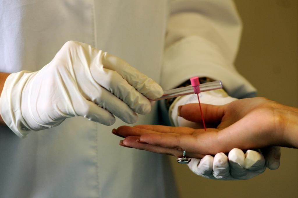 SES reforça ações para enfrentar a hanseníase em Mato Grosso