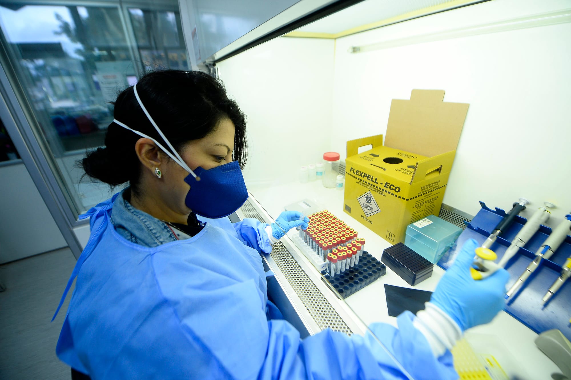 Laboratório Central de Saúde Pública do DF superou marca de 550 mil exames em 2025