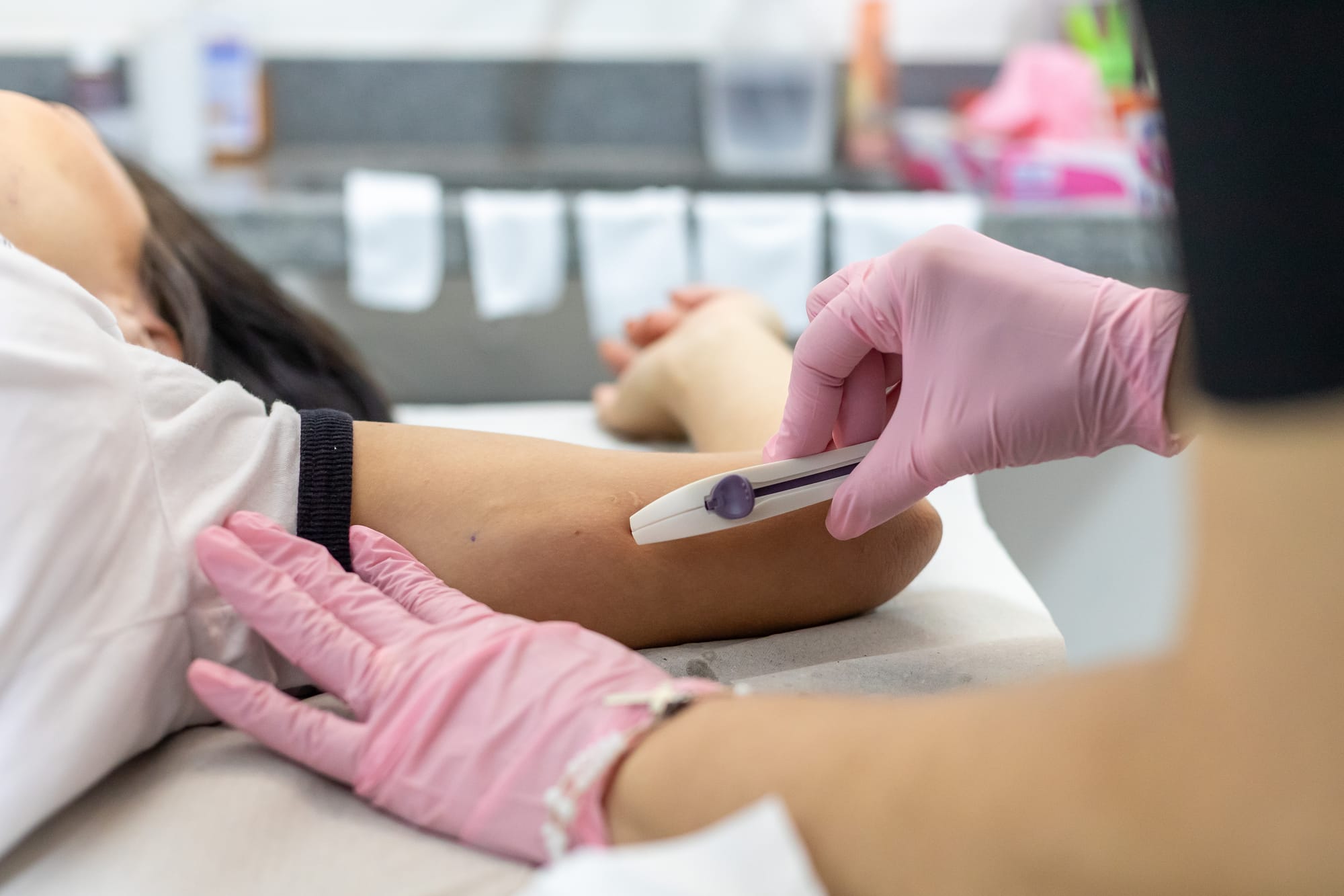 Saiba como funciona a inserção do implante contraceptivo nas USFs de Cuiabá-MT