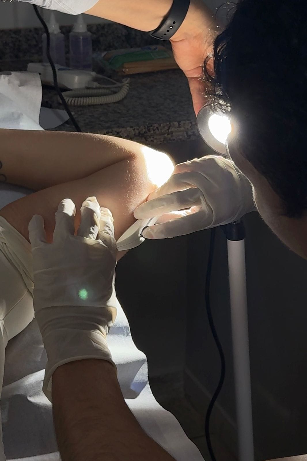 Prefeitura de Aparecida-GO inicia oferta do implante contraceptivo implanon