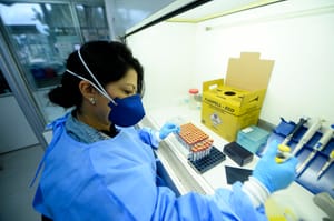 Laboratório Central de Saúde Pública do DF superou marca de 550 mil exames em 2025