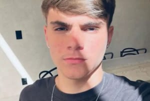 Adolescente agredido em briga no DF morre após 16 dias internado